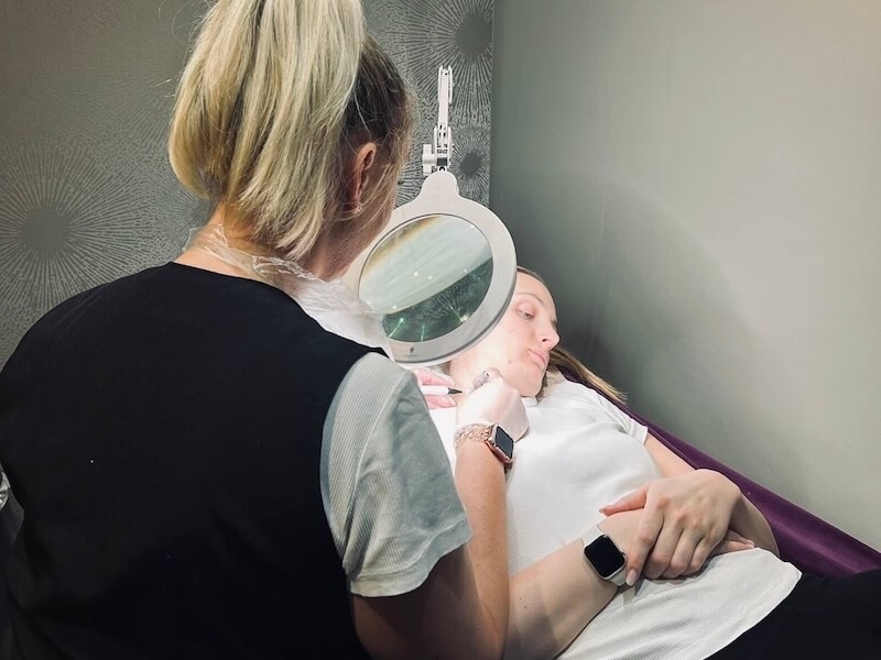 Advanced Blemish Removal 3b Ear Piercing Salon Thame